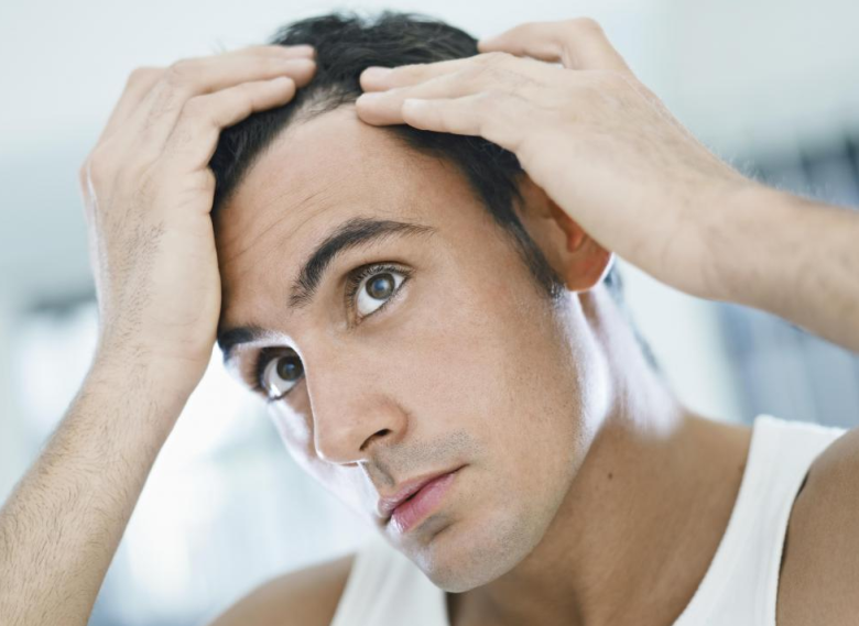 Ispadanje kose nije tako loše za cjelokupan izgled, no izaziva li zdravstvene probleme?